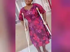 Malawian woman appeals for help to fund life-saving surgery after devastating accident